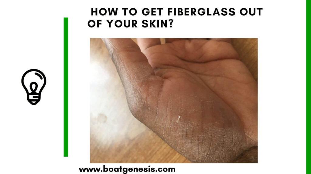 How to get fiberglass out of your skin - featured image